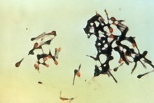 Clostridium-tetani.jpg